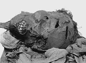 The head of Seqenre Tao showing (some of) his death wounds